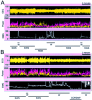 Fig. 11.